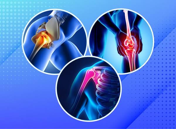Joint Replacement