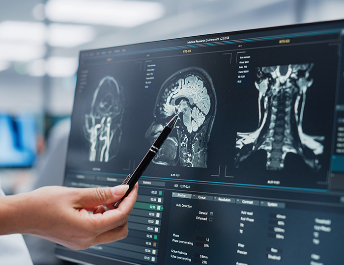 Neurology Care